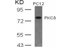Image no. 3 for anti-Protein Kinase C, delta (PKCd) (AA 643-647) antibody (ABIN197564) (PKC delta antibody  (AA 643-647))
