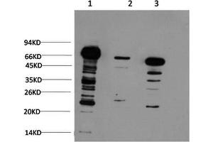 Western Blotting (WB) image for anti-Ubiquitin (Ubiquitin) antibody (ABIN5958540) (Ubiquitin antibody)