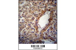 ACSS2 Antibody immunohistochemistry analysis in formalin fixed and paraffin embedded human liver tissue followed by peroxidase conjugation of the secondary antibody and DAB staining. (ACSS2 antibody  (AA 261-290))