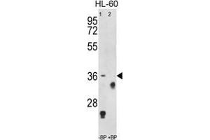 Western blot analysis of anti-TNFRSF14 Antibody (Center) Pab pre-incubated without(lane 1) and with (lane 2) blocking peptide in HL-60 cell line lysate. (HVEM antibody  (Middle Region))