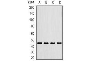 Western blot analysis of Gastric Lipase expression in MCF7 (A), mouse lung (B), mouse liver (C), rat kidney (D) whole cell lysates.