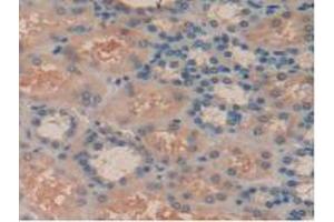 IHC-P analysis of Human Kidney Tissue, with DAB staining. (SYK antibody  (AA 374-635))