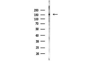 Western blot analysis of lysates from COLO205 cells(heat-shock,45 min treatment), using Phospho-ASK1 (Ser966) Antibody at 1/1000 dilution.