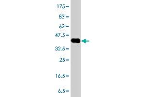 Western Blot detection against Immunogen (38. (RASGRP3 antibody  (AA 581-690))