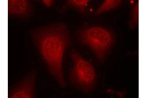 Immunofluorescence staining of methanol-fixed Hela cells using HDAC8(Phospho-Ser39) Antibody. (HDAC8 antibody  (pSer39))