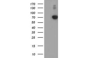 Western Blotting (WB) image for anti-alpha-Fetoprotein (AFP) antibody (ABIN1496491) (alpha Fetoprotein antibody)