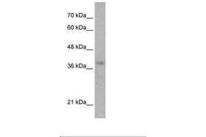 Image no. 1 for anti-POU Domain, Class 4, Transcription Factor 2 (POU4F2) (N-Term) antibody (ABIN6736281) (POU4F2 antibody  (N-Term))