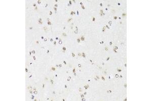 Immunohistochemistry (Paraffin-embedded Sections) (IHC (p)) image for anti-Elongation Factor Tu GTP Binding Domain Containing 2 (EFTUD2) (AA 1-205) antibody (ABIN6139968)