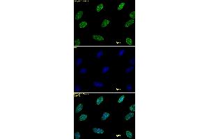 Histone H3 dimethyl Lys9 antibody tested by immunofluorescence. (Histone 3 antibody  (2meLys9))