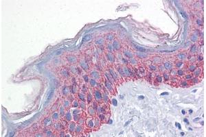 Anti-BUB1B / BubR1 antibody IHC staining of human skin. (BUB1B antibody  (AA 1-130))