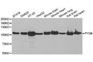 Western blot analysis of extracts of various cell lines, using PYGB antibody. (PYGB antibody)