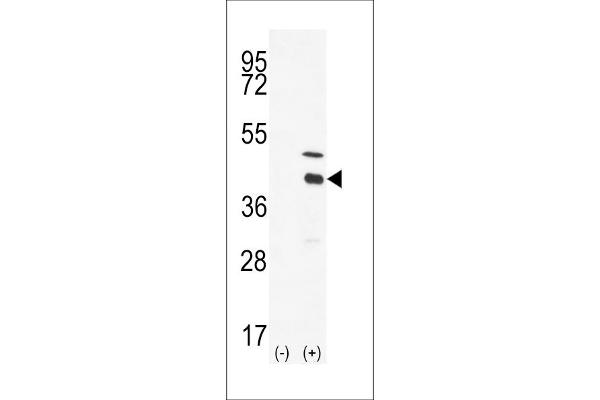 DOK4 antibody  (C-Term)