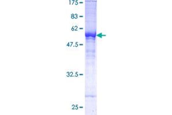 TFPI Protein (AA 1-251) (GST tag)