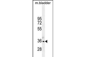 TGIF1 Antibody (Center ) (ABIN655999 and ABIN2845378) western blot analysis in mouse bladder tissue lysates (35 μg/lane).