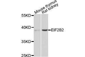 Western blot analysis of extracts of various cell lines, using EIF2B2 antibody (ABIN5975464) at 1/1000 dilution. (EIF2B2 antibody)