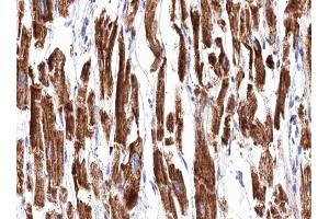 ABIN6266853 at 1/100 staining human Heart muscle tissue sections by IHC-P.