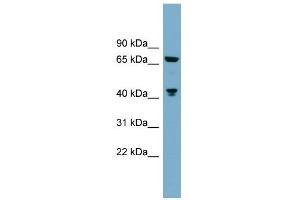 WB Suggested Anti-GLS Antibody Titration: 0. (Glutaminase antibody  (C-Term))