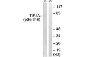 Western blot analysis of extracts from Jurkat cells treated with starved 24h, using TIF-IA (Phospho-Ser649) Antibody. (RRN3 antibody  (pSer649))