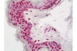 Human Skin: Formalin-Fixed, Paraffin-Embedded (FFPE)