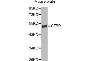 Western blot analysis of extracts of mouse brain, using CTBP1 Antibody (ABIN5970855) at 1/1000 dilution. (CTBP1 antibody)