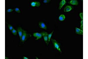 Immunofluorescent analysis of Hela cells using ABIN7163601 at dilution of 1:100 and Alexa Fluor 488-congugated AffiniPure Goat Anti-Rabbit IgG(H+L) (PAFAH1B1 antibody  (AA 40-155))