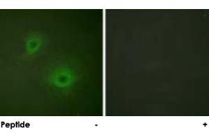 Immunofluorescence analysis of HUVEC cells, using EPHB1/EPHA2 polyclonal antibody .