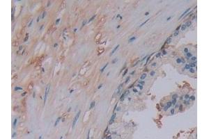 Immunohistochemistry (IHC) image for anti-Choline O-Acetyltransferase (CHAT) (AA 517-732) antibody (ABIN7440704)