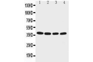 Anti-EIF2S2 antibody, Western blotting Lane 1: M451 Cell Lysate Lane 2: JURKAT Cell Lysate Lane 3: HELA Cell Lysate Lane 4:293T Cell Lysate