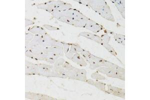 Immunohistochemistry of paraffin-embedded mouse heart using BAZ1B antibody (ABIN6003583) at dilution of 1/100 (40x lens). (BAZ1B antibody)