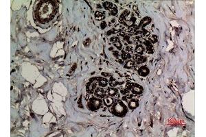 Immunohistochemistry (IHC) analysis of paraffin-embedded Human Breast, antibody was diluted at 1:100. (p53 antibody  (2meLys370))