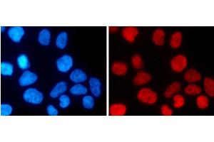 Immunofluorescence analysis of 293T cells using MonoMethyl-Histone H3-K27 Polyclonal Antibody (Histone 3 antibody  (meLys27))