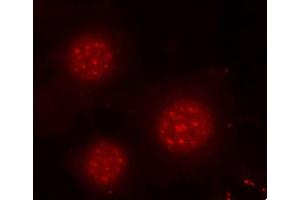 Immunofluorescence staining of methanol-fixed MCF-7 cells using Phospho-FOXO4-S197 antibody (ABIN2987524). (FOXO4 antibody  (pSer197))