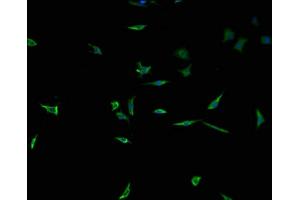Immunofluorescence staining of SH-SY5Y cells with ABIN7173488 at 1:100, counter-stained with DAPI.