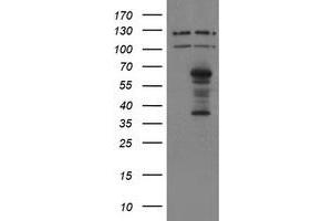 Image no. 1 for anti-SUMO1/sentrin/SMT3 Specific Peptidase 2 (SENP2) (AA 139-523) antibody (ABIN1490928)