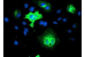 Anti-TMEM80 mouse monoclonal antibody (ABIN2453728) immunofluorescent staining of COS7 cells transiently transfected by pCMV6-ENTRY TMEM80 (RC202288). (TMEM80 antibody)