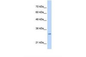 Image no. 1 for anti-Myeloid Leukemia Factor 2 (MLF2) (C-Term) antibody (ABIN6738256) (MLF2 antibody  (C-Term))