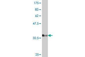 Collagen, Type XXIV, alpha 1 (COL24A1) (AA 1626-1714) antibody