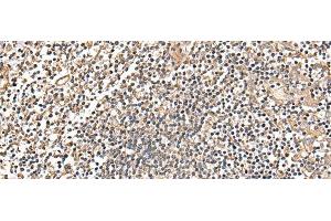 Immunohistochemistry of paraffin-embedded Human tonsil tissue using MRPS18C Polyclonal Antibody at dilution of 1:25(x200) (MRPS18C antibody)