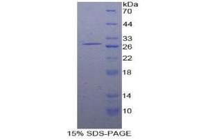 SDS-PAGE analysis of Human SLAMF5 Protein. (Signaling Lymphocytic Activation Molecule Family, Member 5 Protein)