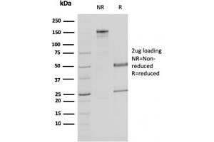 SDS-PAGE Analysis Purified MDH1 Mouse Monoclonal Antibody (CPTC-MDH1-1).