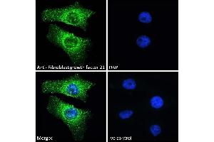 (ABIN238569) Immunofluorescence analysis of paraformaldehyde fixed HeLa cells, permeabilized with 0. (FGF21 antibody  (Internal Region))
