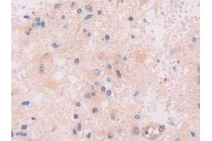 Immunohistochemistry (IHC) image for anti-Interferon, gamma-Inducible Protein 16 (IFI16) (AA 465-671) antibody (ABIN7442042)
