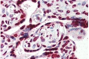 Human Placenta (formalin-fixed, paraffin-embedded) stained with HMGA1 antibody ABIN364402 at 4 ug/ml followed by biotinylated anti-goat IgG secondary antibody ABIN481715, alkaline phosphatase-streptavidin and chromogen. (HMGA1 antibody  (AA 12-23))