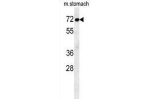 Western Blotting (WB) image for anti-Activating Transcription Factor 7 Interacting Protein 2 (ATF7IP2) antibody (ABIN2995682)
