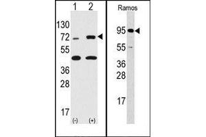 Image no. 1 for anti-Ribosomal Protein S6 Kinase, 90kDa, Polypeptide 3 (RPS6KA3) (N-Term) antibody (ABIN360345) (RPS6KA3 antibody  (N-Term))