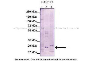 Western Blotting (WB) image for anti-Hepatitis A Virus Cellular Receptor 2 (TIM 3) (N-Term) antibody (ABIN2782255)