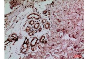 Immunohistochemistry (IHC) analysis of paraffin-embedded Human Skin, antibody was diluted at 1:100. (IL-1 beta antibody  (Internal Region))