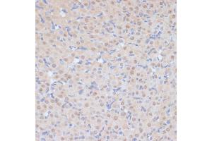 Immunohistochemistry of paraffin-embedded rat ovary using CDK9 antibody (ABIN6129241, ABIN6138331, ABIN6138332 and ABIN6214015) at dilution of 1:100 (40x lens). (CDK9 antibody  (AA 153-372))