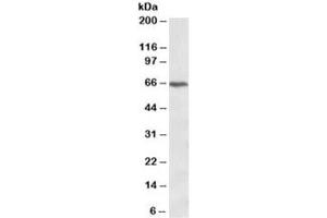 Western blot testing of Jurkat lysate with CACNB2 antibody at 1ug/ml. (CACNB2 antibody)