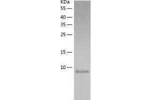 Western Blotting (WB) image for S100 Calcium Binding Protein A16 (S100A16) (AA 1-103) protein (His tag) (ABIN7288348) (S100A16 Protein (AA 1-103) (His tag))